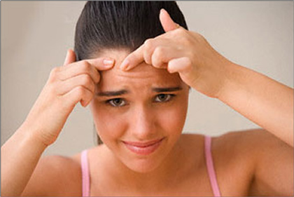 4 Formas rapidas de eliminar el acné